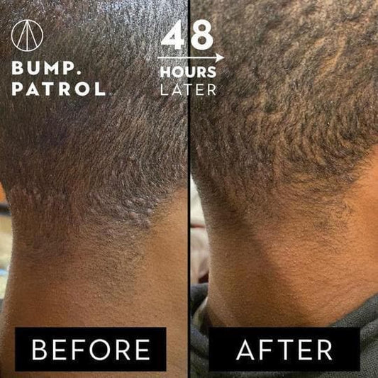 Bump Patrol After Shave - Maximum Strength 4oz