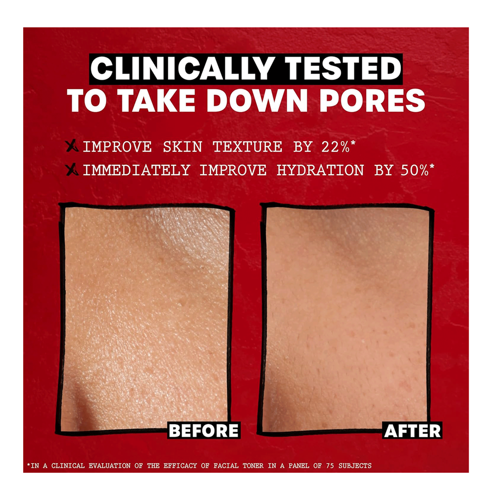 Thayers Alcohol-Free Witch Hazel Toner - Unscented