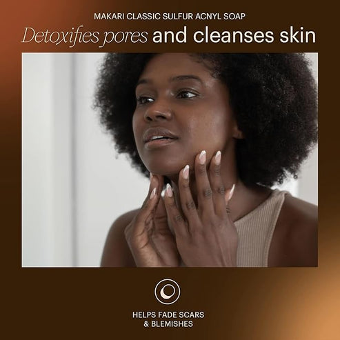 Advertisement for Makari Classic Sulfur Acnyl Soap featuring a woman touching her face.