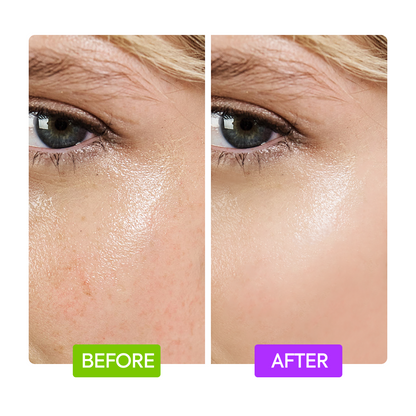 Makari IYKYK Niacinamide Booster Before After