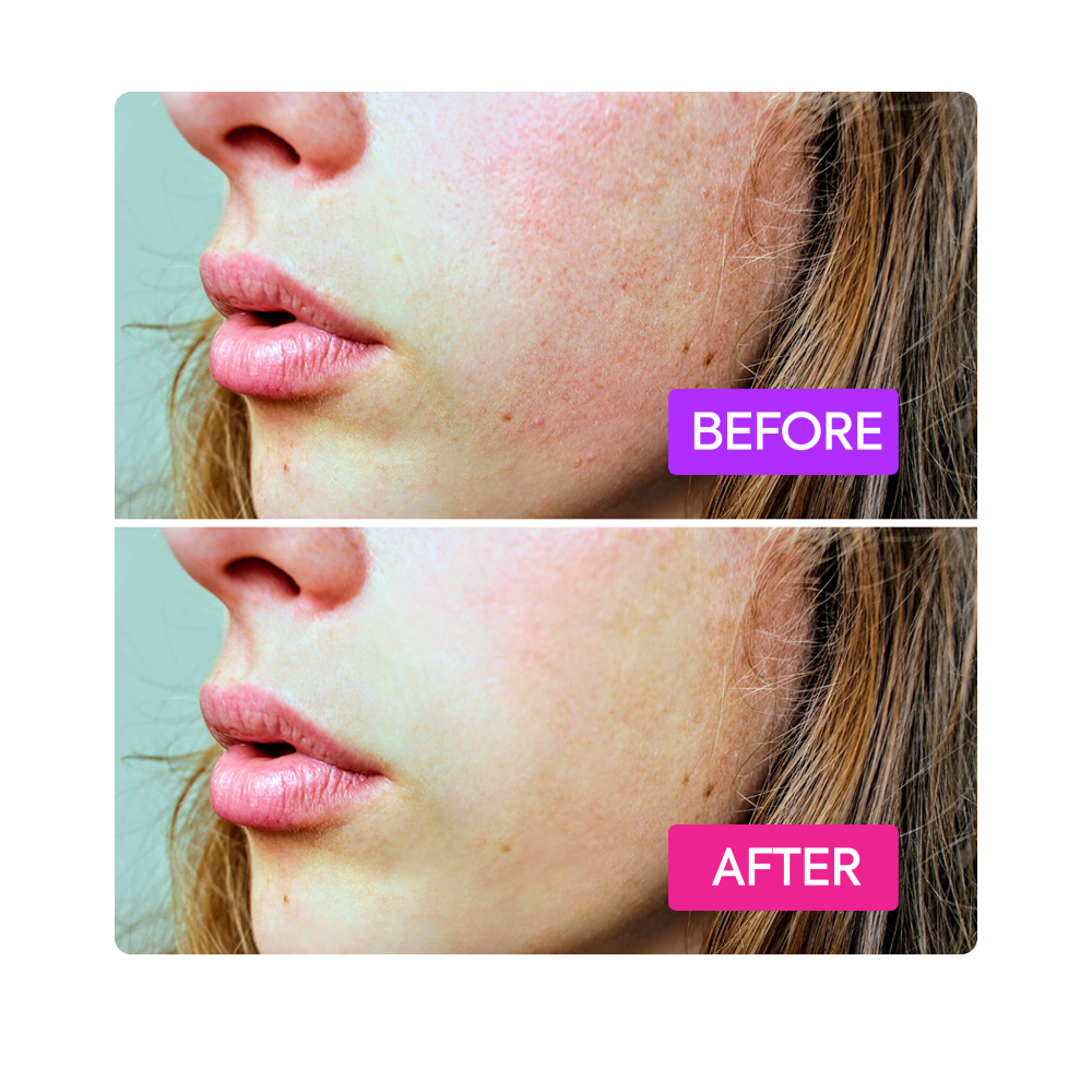 Before After Makari IYKYK  Booster