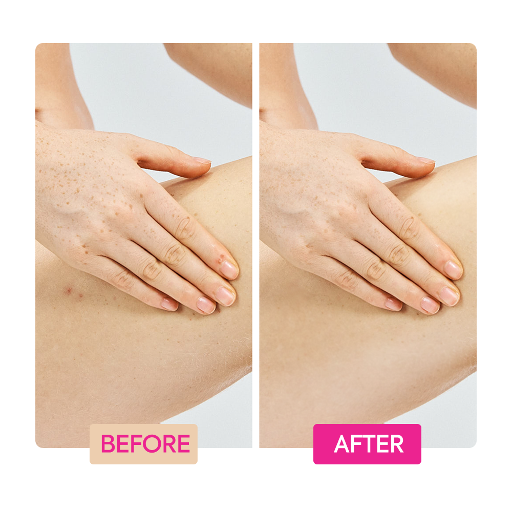 Before and after comparison of Makari IYKYK Ginger Extract + Tranexamic Acid + Retinol Body Toning Cream on a person's skin on a white background