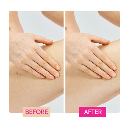 Before and after comparison of Makari IYKYK Ginger Extract + Tranexamic Acid + Retinol Body Toning Cream on a person's skin on a white background