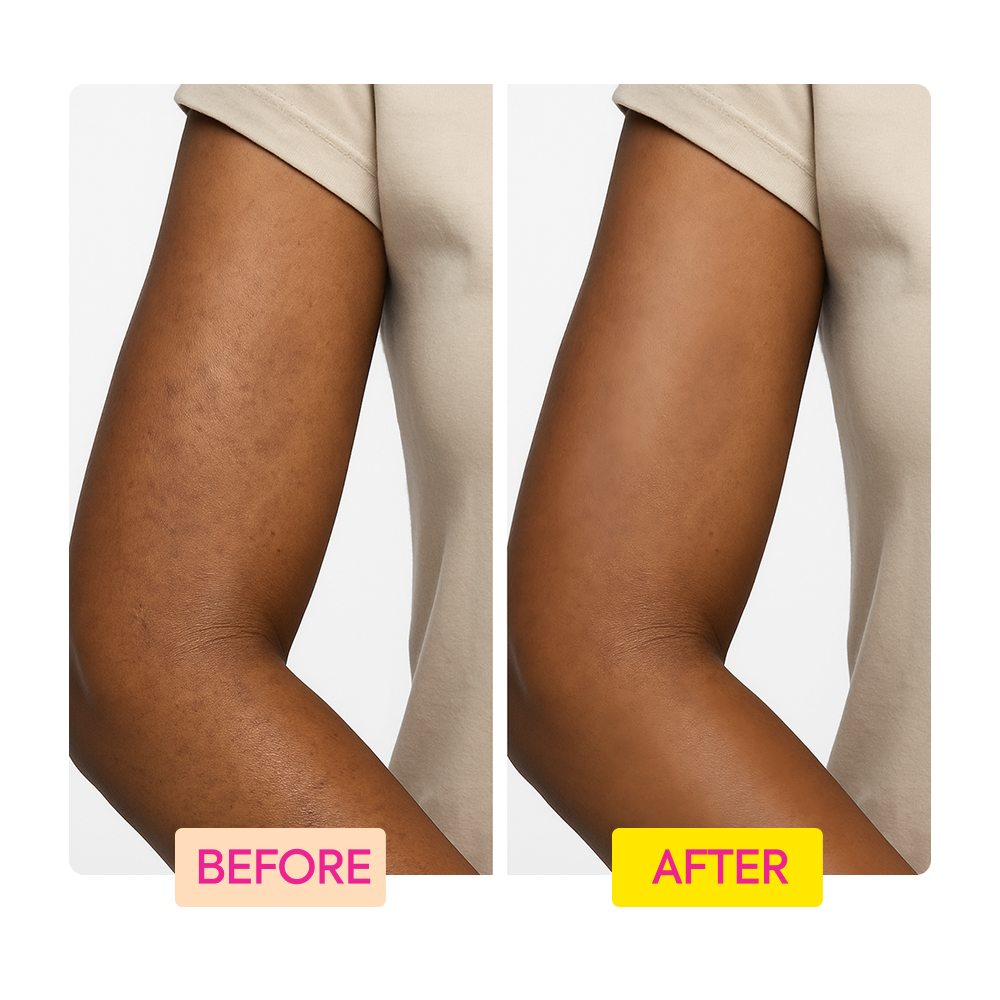 Makari IYKYK Ceramide Collagen + Peptides Body Toning Cream Before and after comparison of an arm with visible skin texture changes.