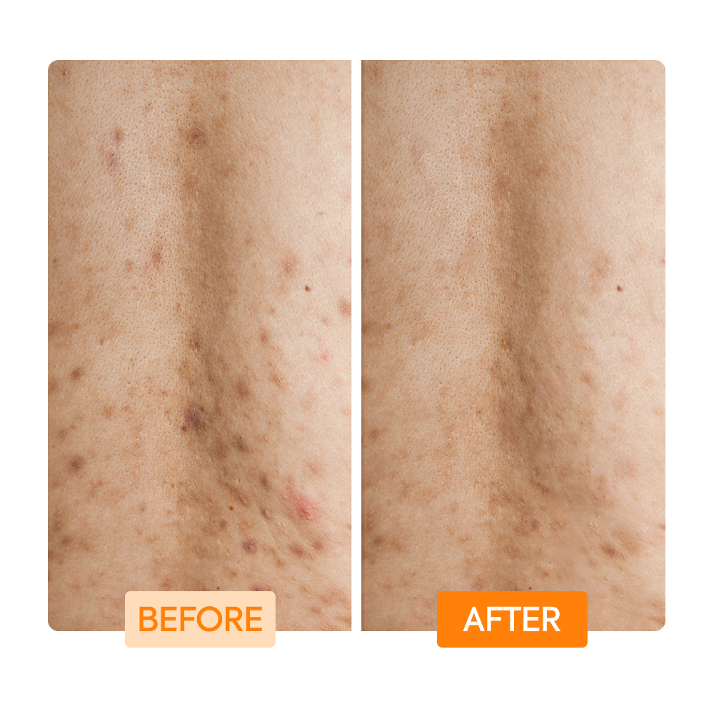 Makari IYKYK Glycolic + Lactic Acid + Niacinamide Body Wash