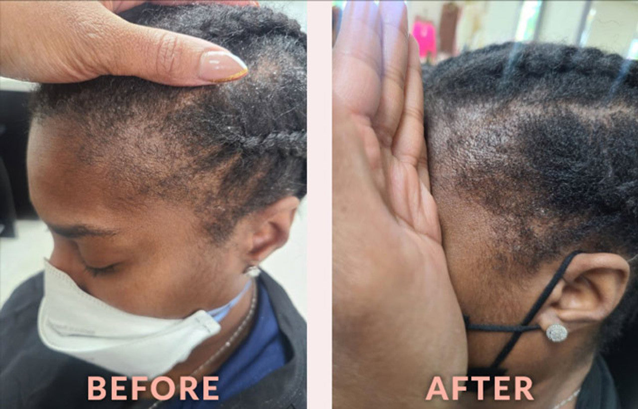 Design Essentials Scalp Care Edge & Temple Strengthening Oil