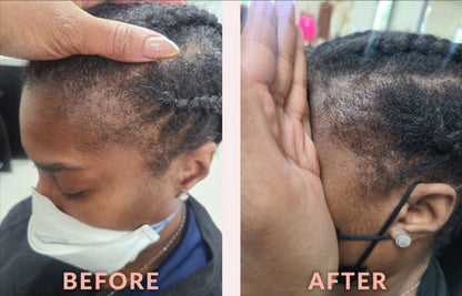 Design Essentials Scalp Care Edge & Temple Strengthening Oil