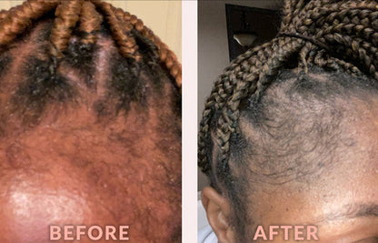 Design Essentials Scalp Care Edge & Temple Strengthening Oil